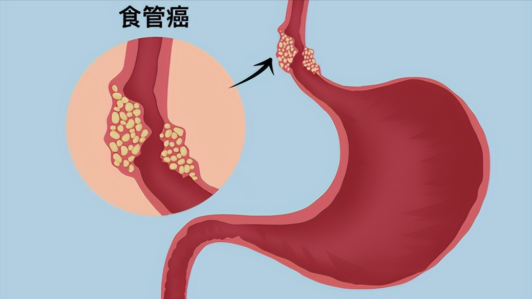 硒的功能是什么