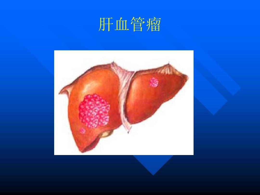补硒能消除肺结节吗