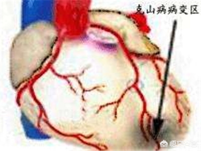 科学补硒选择补充什么硒