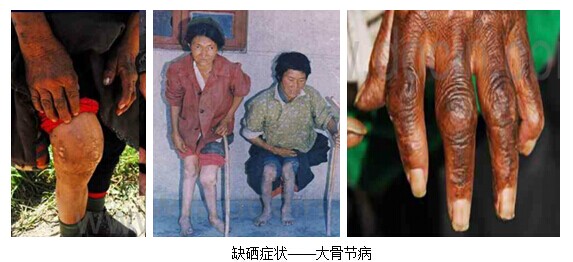 怎么科学补硒