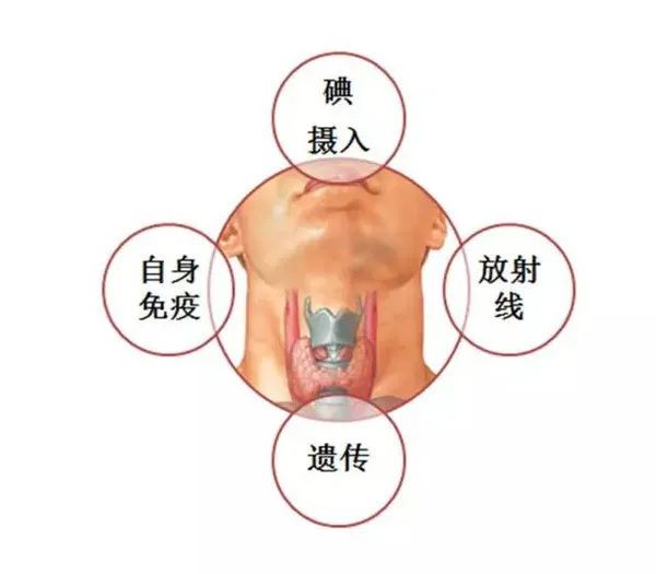 甲状腺肿要补碘还是硒