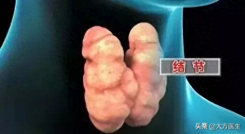 甲亢每天补硒多少毫克