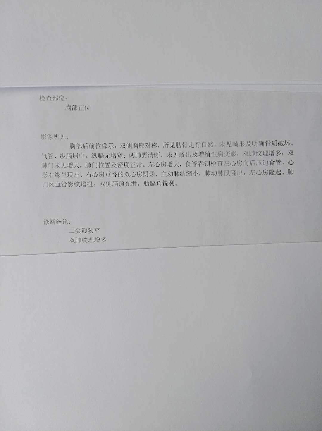 江苏地区补硒病例报告