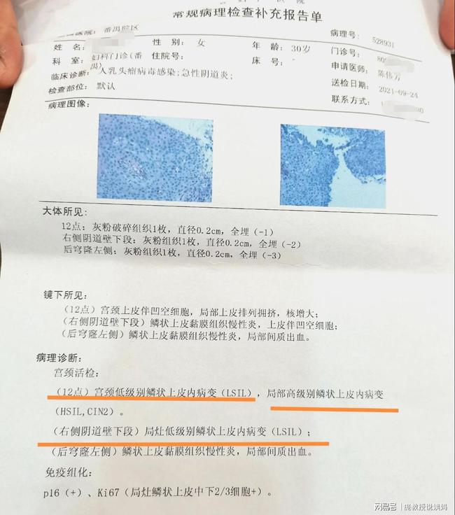 hpv感染补哪种类硒