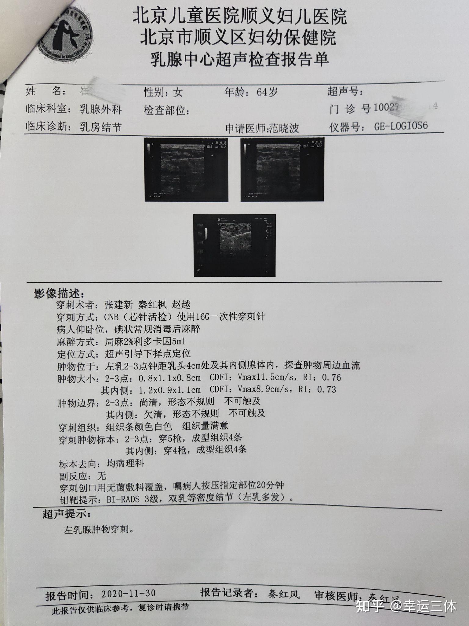 乳腺小叶增生怎么补硒