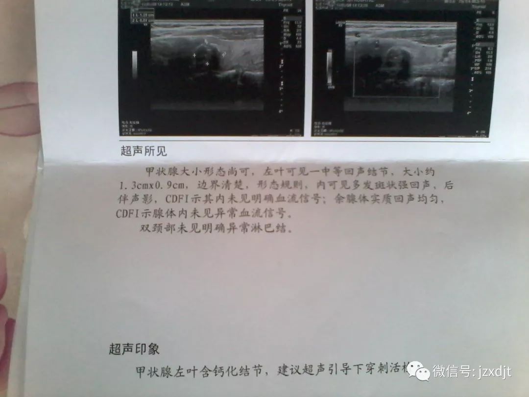 甲状腺结节要终身补硒