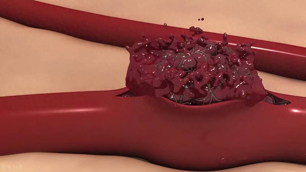 补硒会得甲状腺结节吗