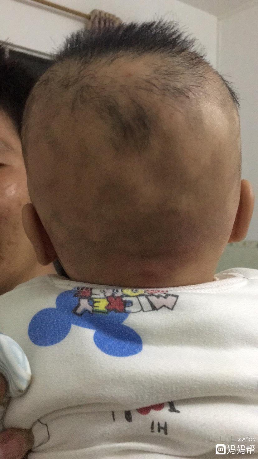 宝宝缺钙铁锌硒怎么补