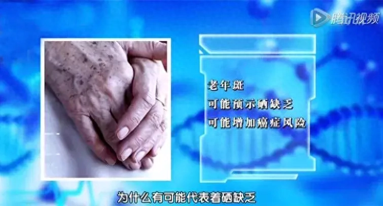 甲状腺补硒食物有那些