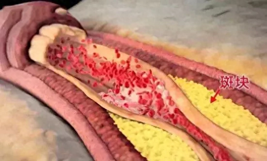甲状腺补硒食物有那些