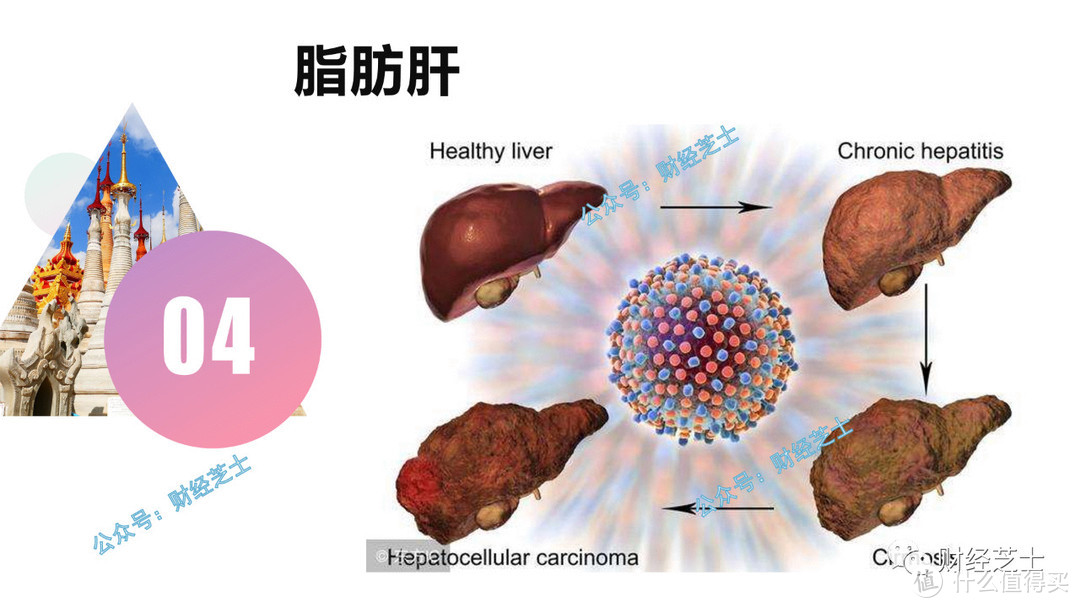 补硒能有效预防痛风吗