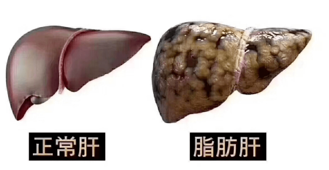 补硒会加重肝脏负担吗