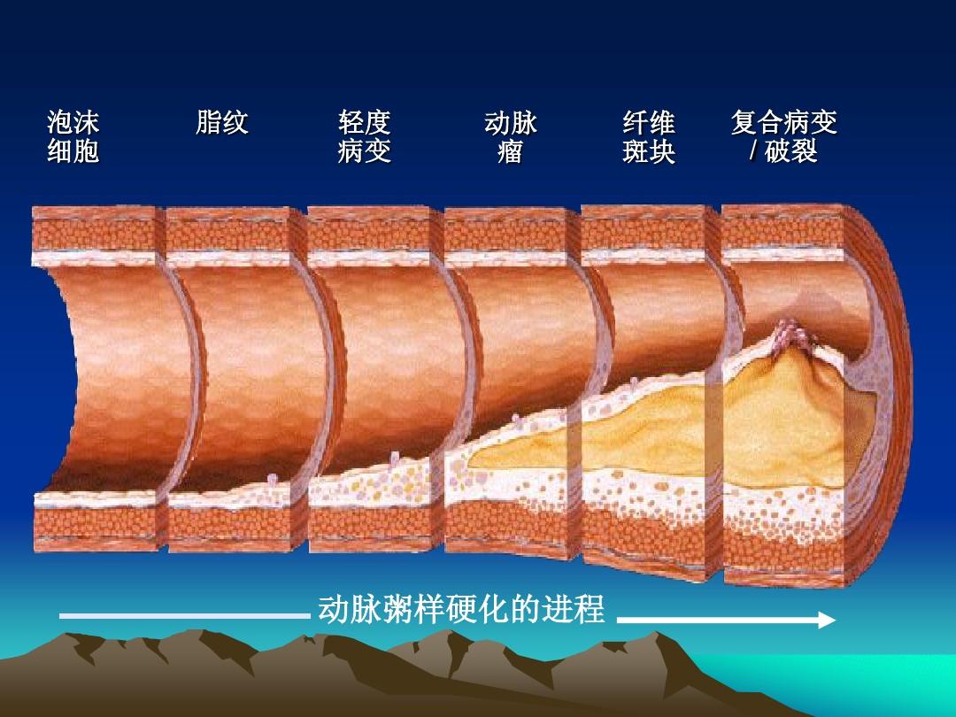 血脂异常还可以补硒嘛
