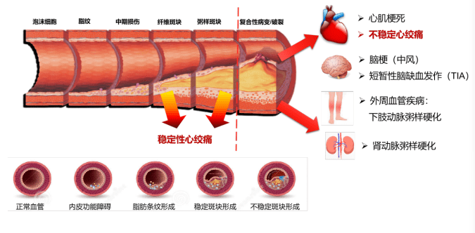 血脂异常还可以补硒嘛