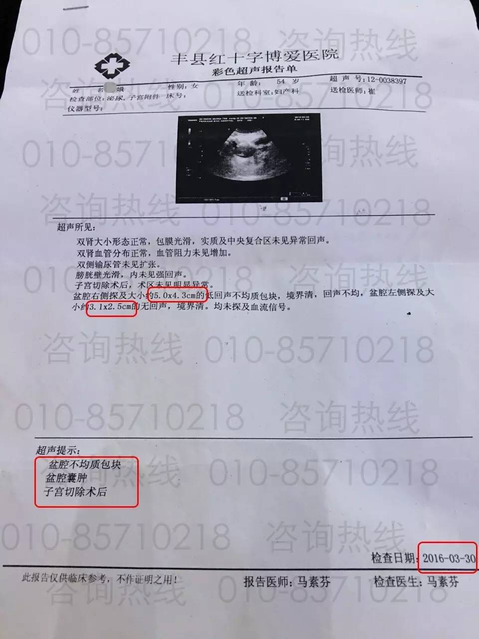 补硒真的让肿瘤消失了
