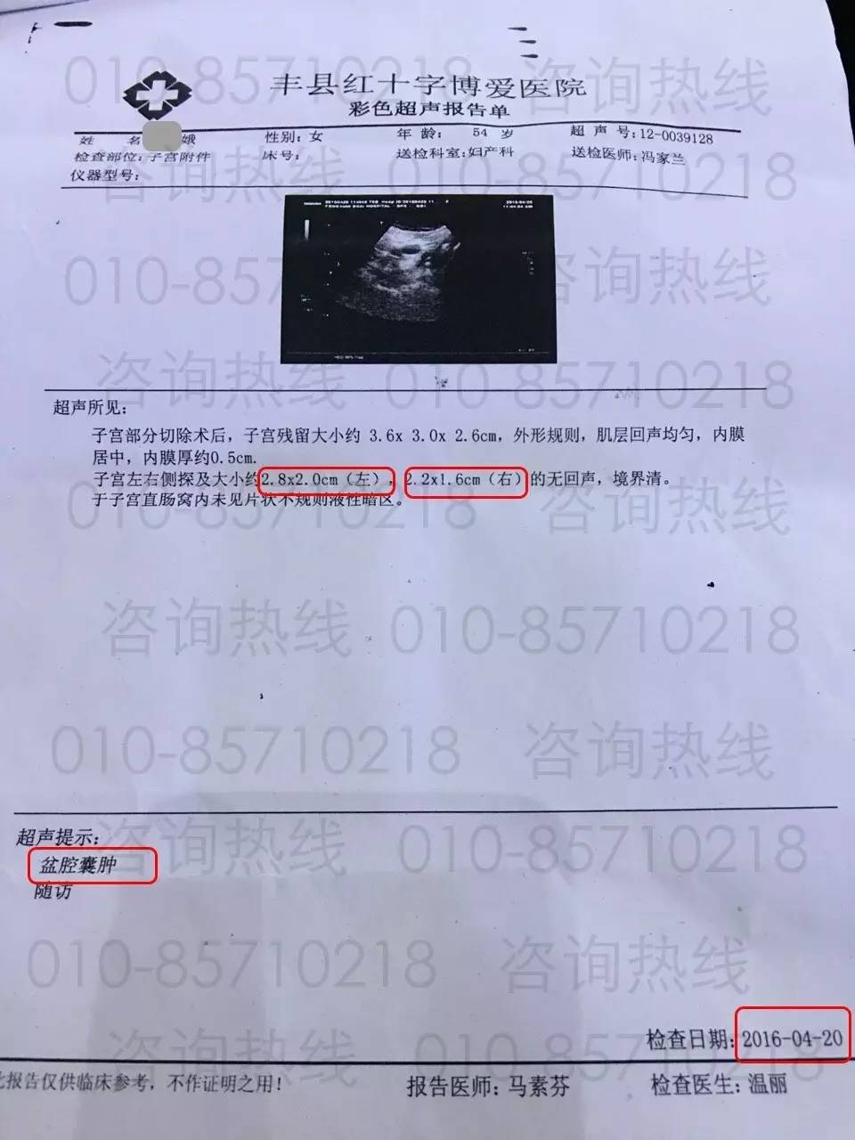 补硒真的让肿瘤消失了