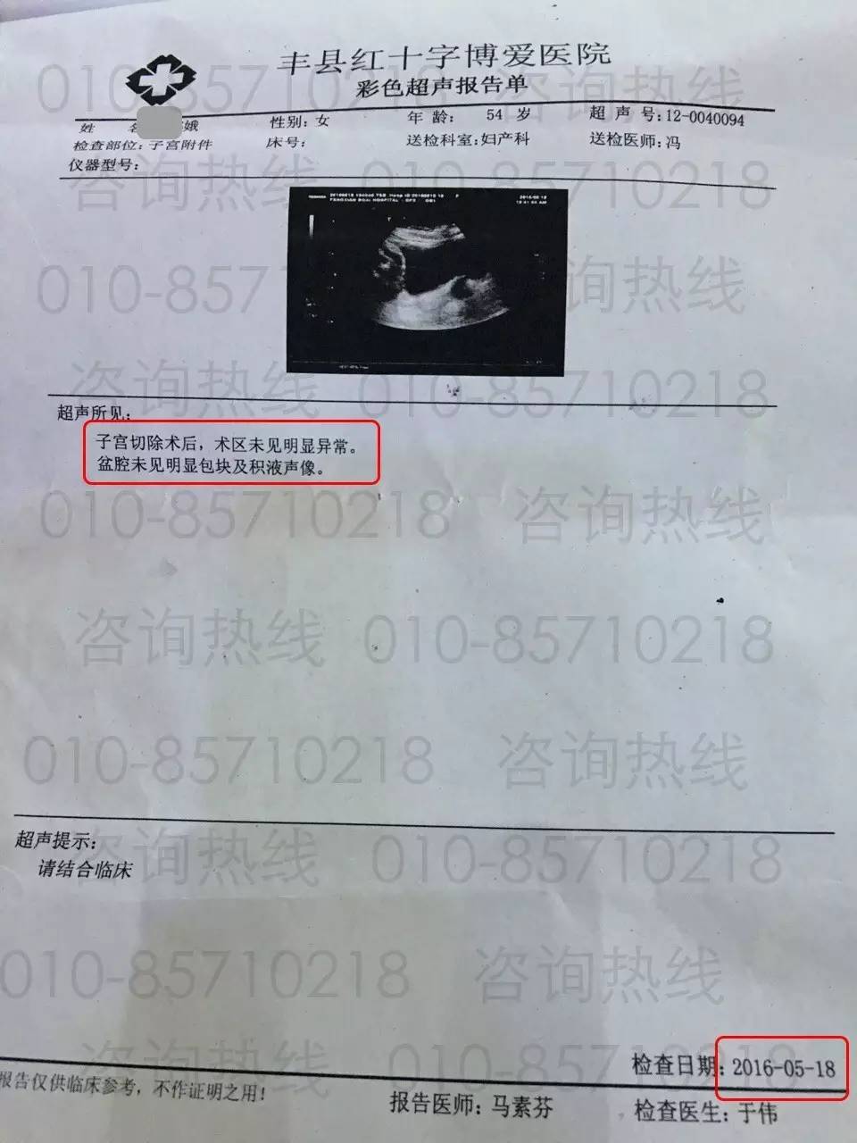 补硒真的让肿瘤消失了