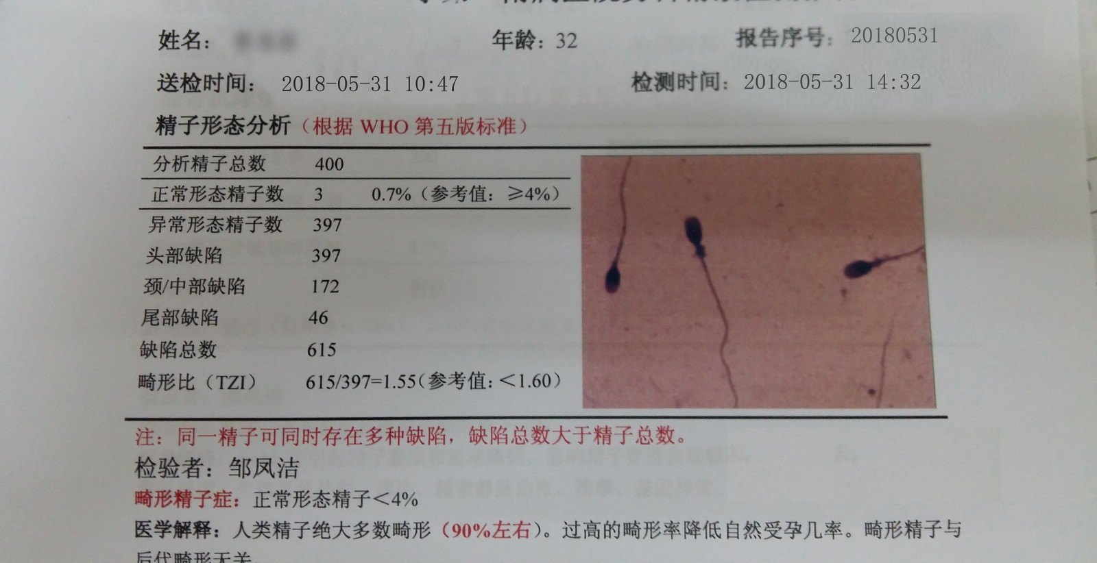 补硒治疗植物神经紊乱