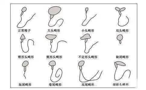 补硒治疗植物神经紊乱