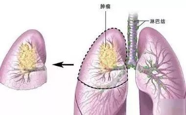 癌症病人补硒每天多少