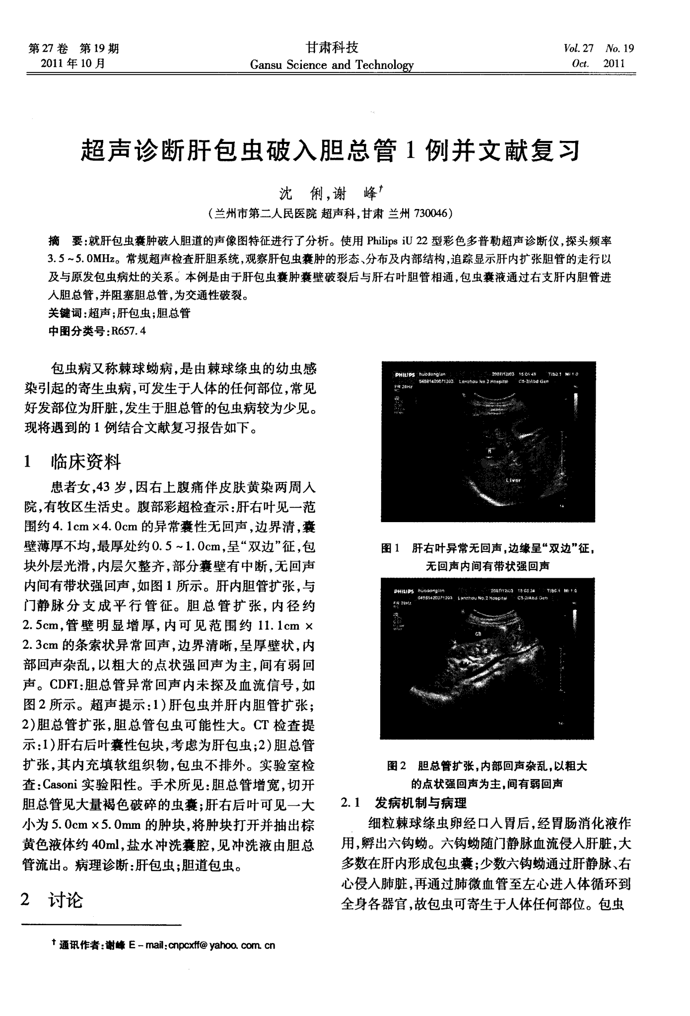甲状腺弥漫性损伤补硒