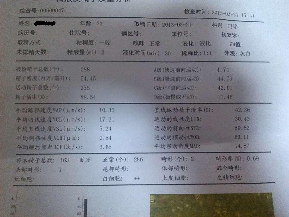 孕前检查医生叫我补硒