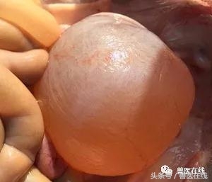 过量补硒对肝脏的危害