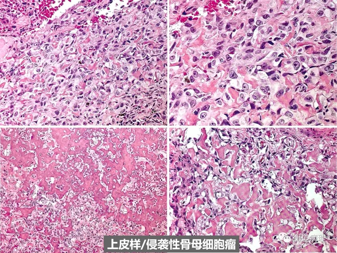 补硒会导致口腔溃疡嘛