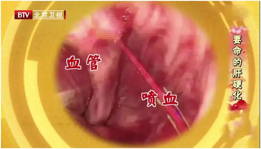 补硒会造成口腔溃疡吗