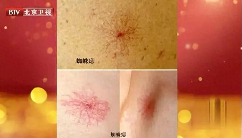 补硒会造成口腔溃疡吗
