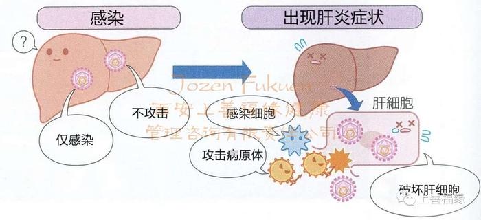 补硒可以避免肝硬化吗