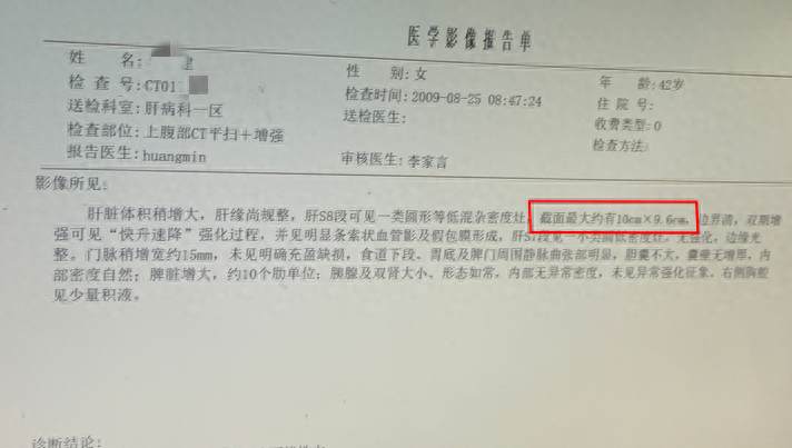 肝癌补硒好吗