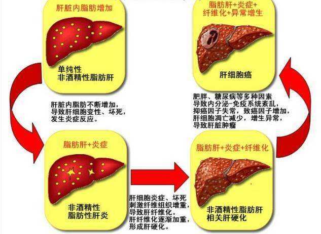 熬夜的人补硒