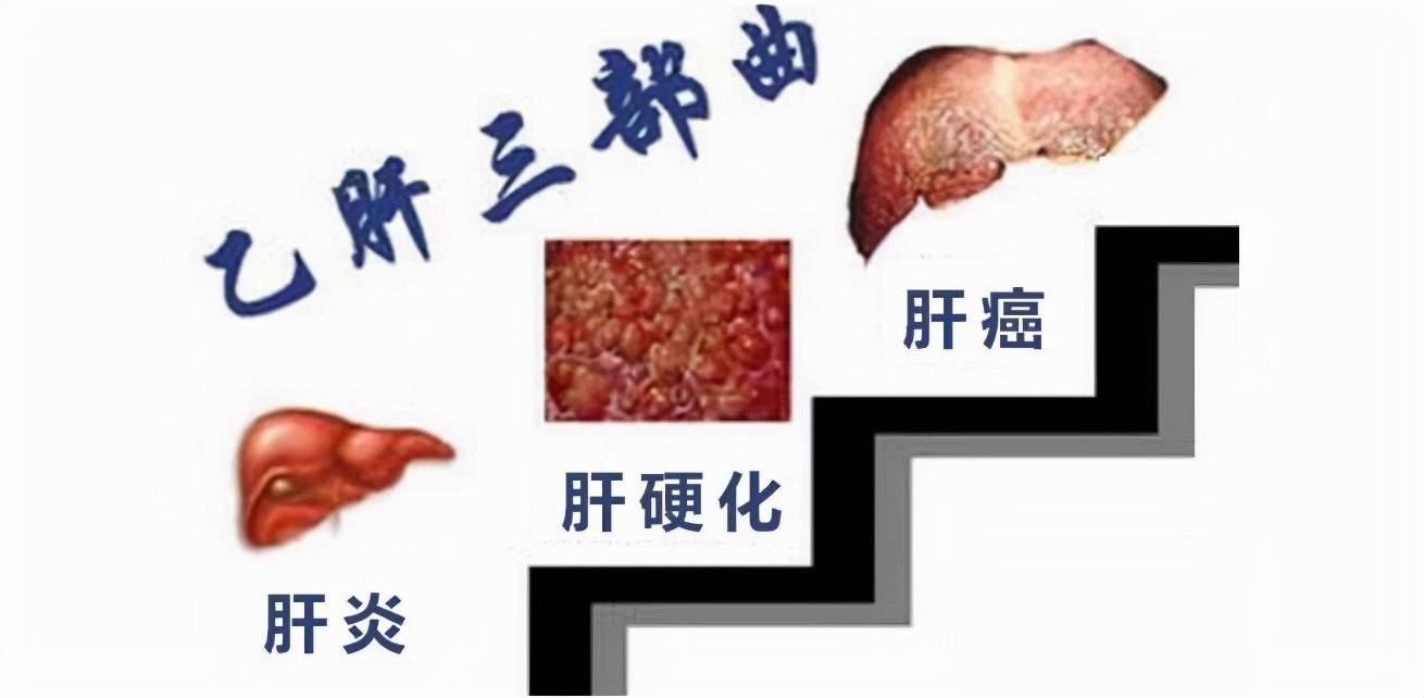 乙肝补多少硒