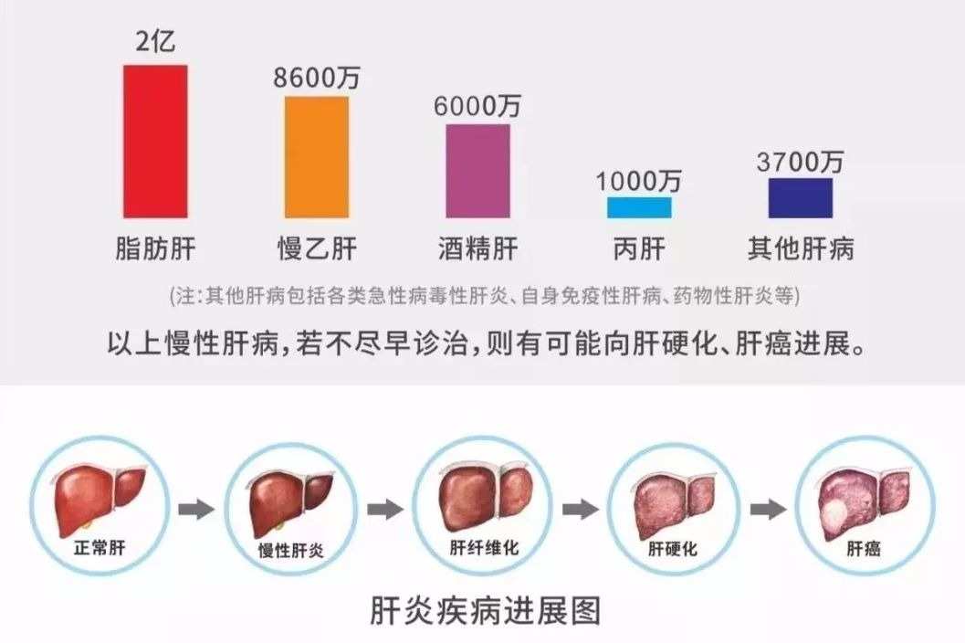 补硒预防肝癌