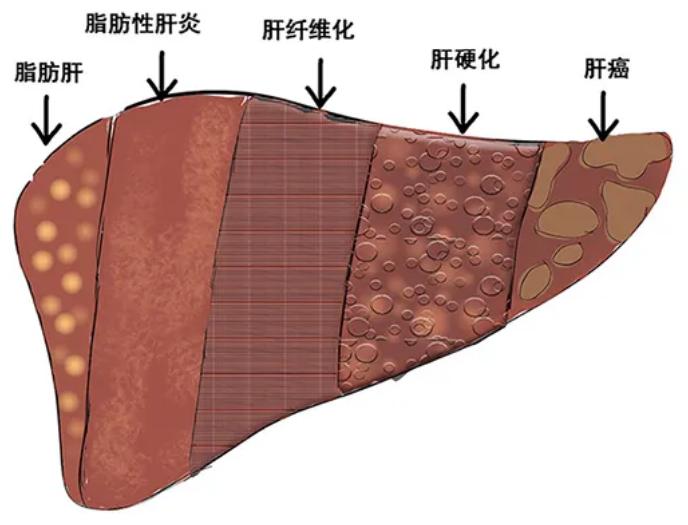补硒引起过敏