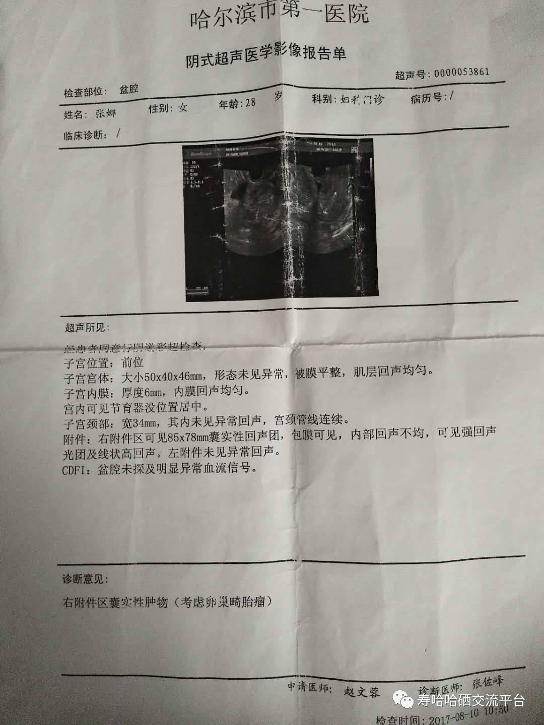 心脏补硒案例