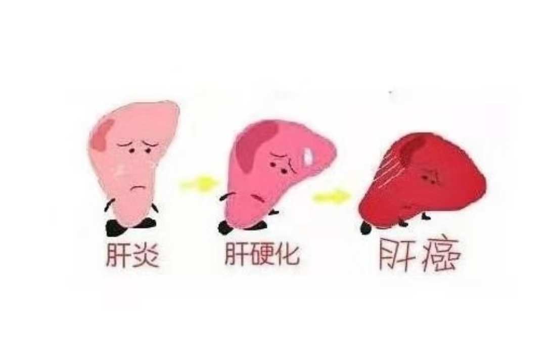 肝血管瘤补硒
