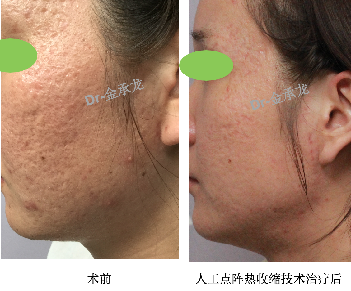 胃寒能补硒吗