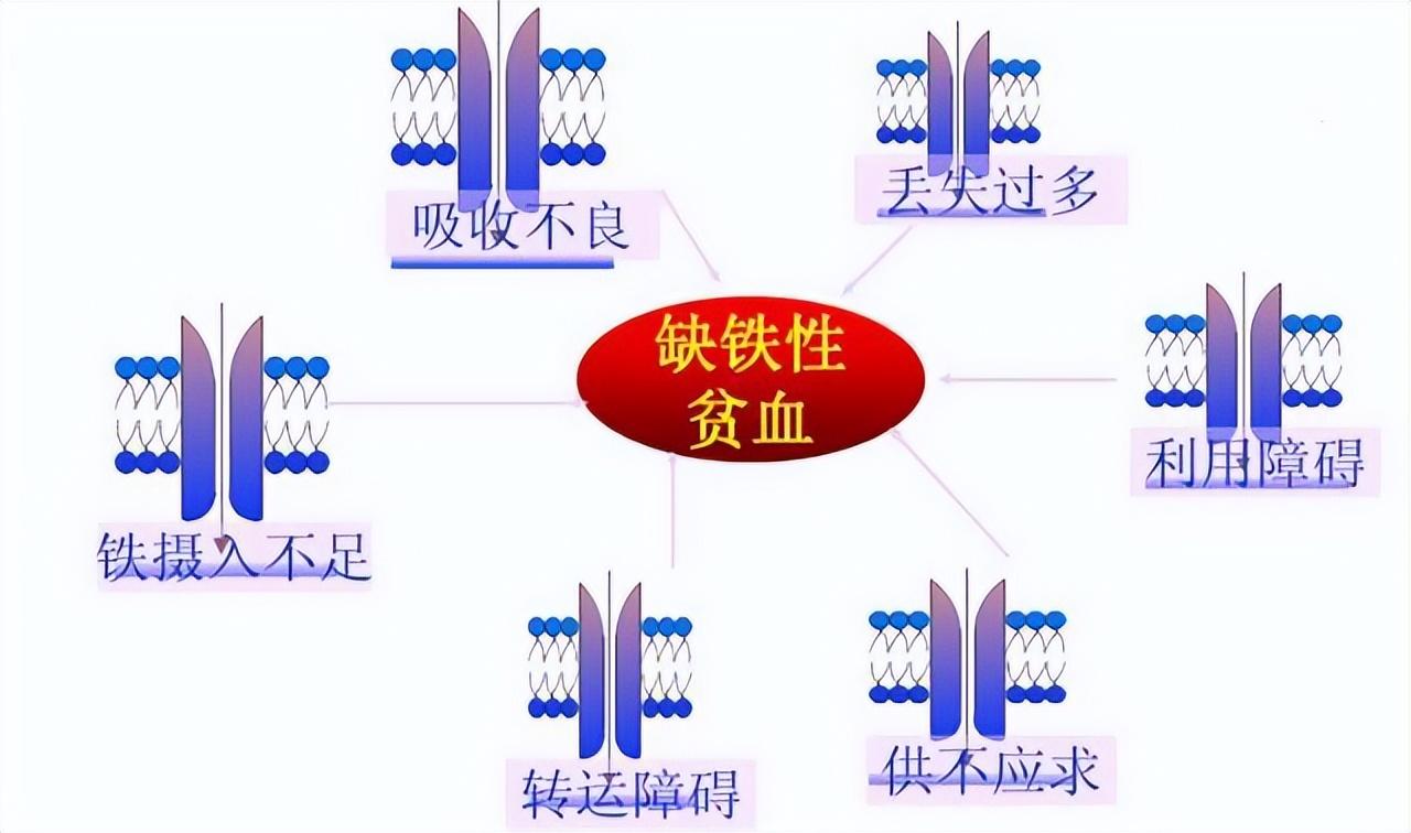 焦磷酸铁补铁效果好吗