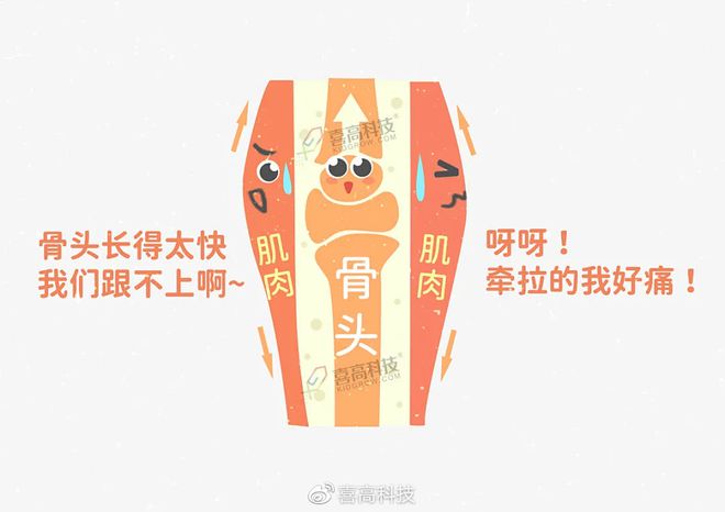生长痛需要补钙吗