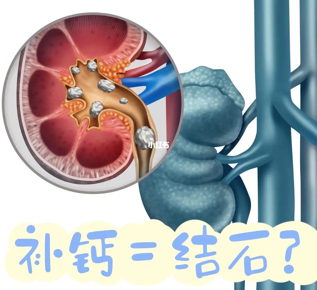 补钙过量会有什么症状