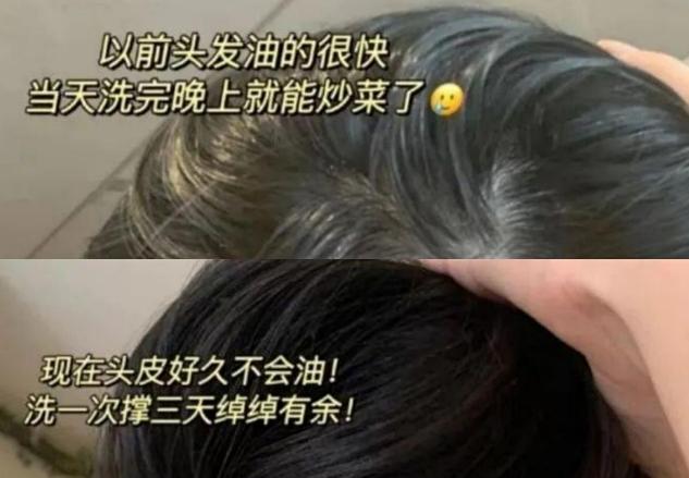 孕妇补锌什么牌子好