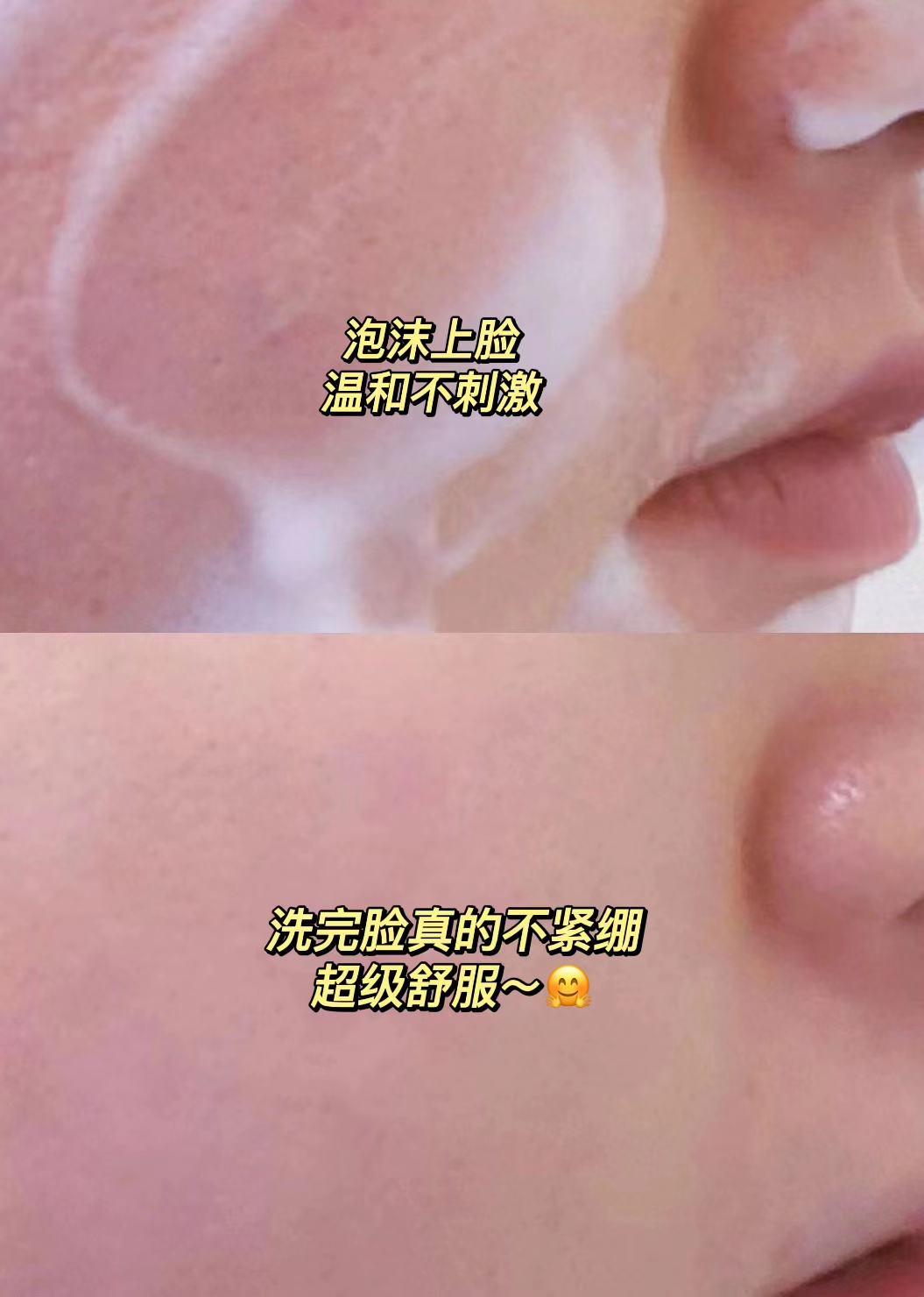 锌硒宝治痘痘