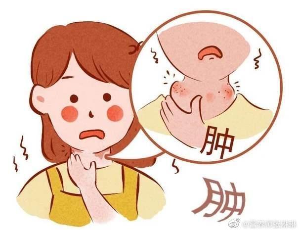 甲减需要补碘吗