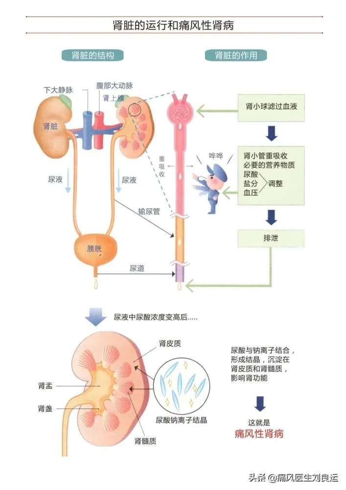 锌硒宝高尿酸