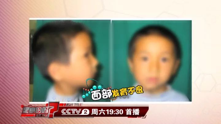 补钙能坚固牙齿吗