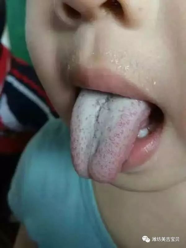 锌硒宝怎么用