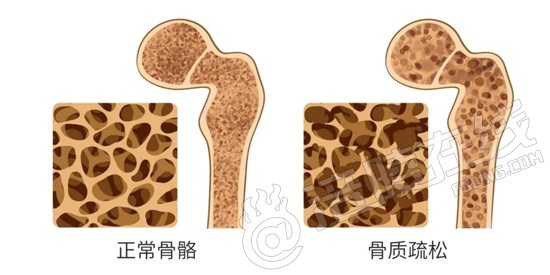 如何给牙齿补钙