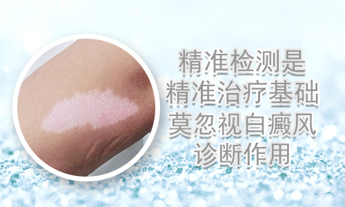 白癜风如何补硒